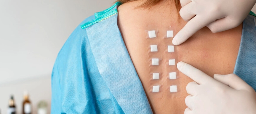 este de alergia sendo realizado nas costas de uma paciente, com adesivos aplicados e profissional de saúde apontando os locais com luvas.